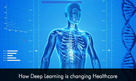 How Deep Learning is changing Healthcare