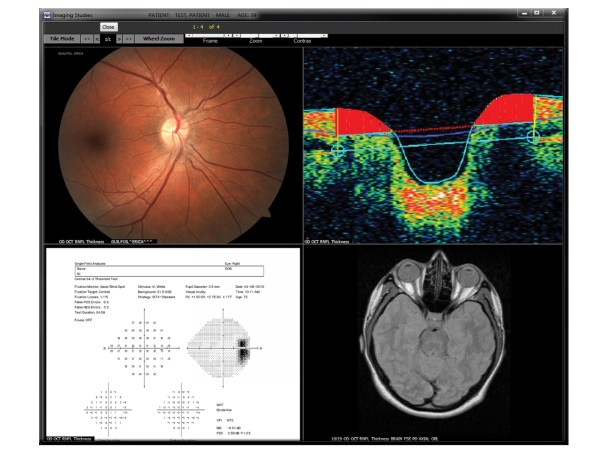 EyeMD EMR Software EHR and Practice Management Software