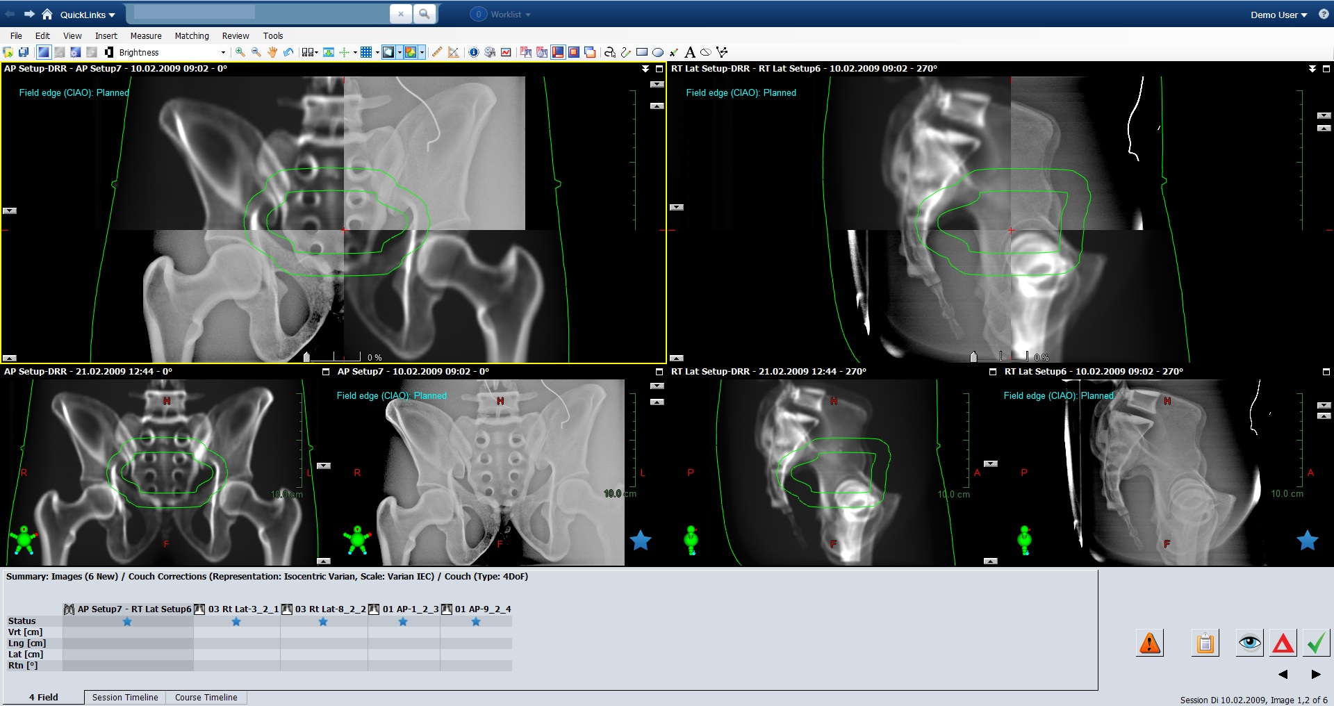 Varian ARIA Oncology EHR Software and patient portal