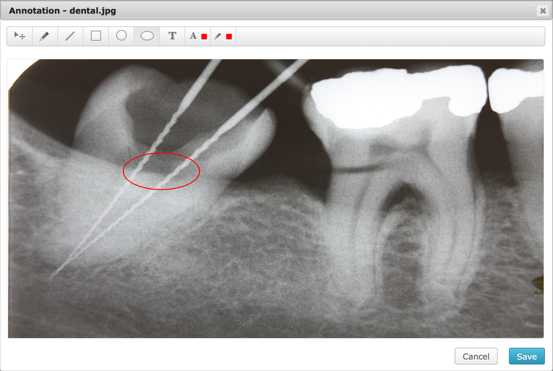 chARM dentistry EHR Software and patient portal