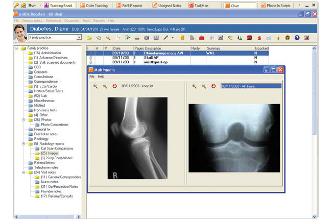 eMDs EHR Software and patient portal