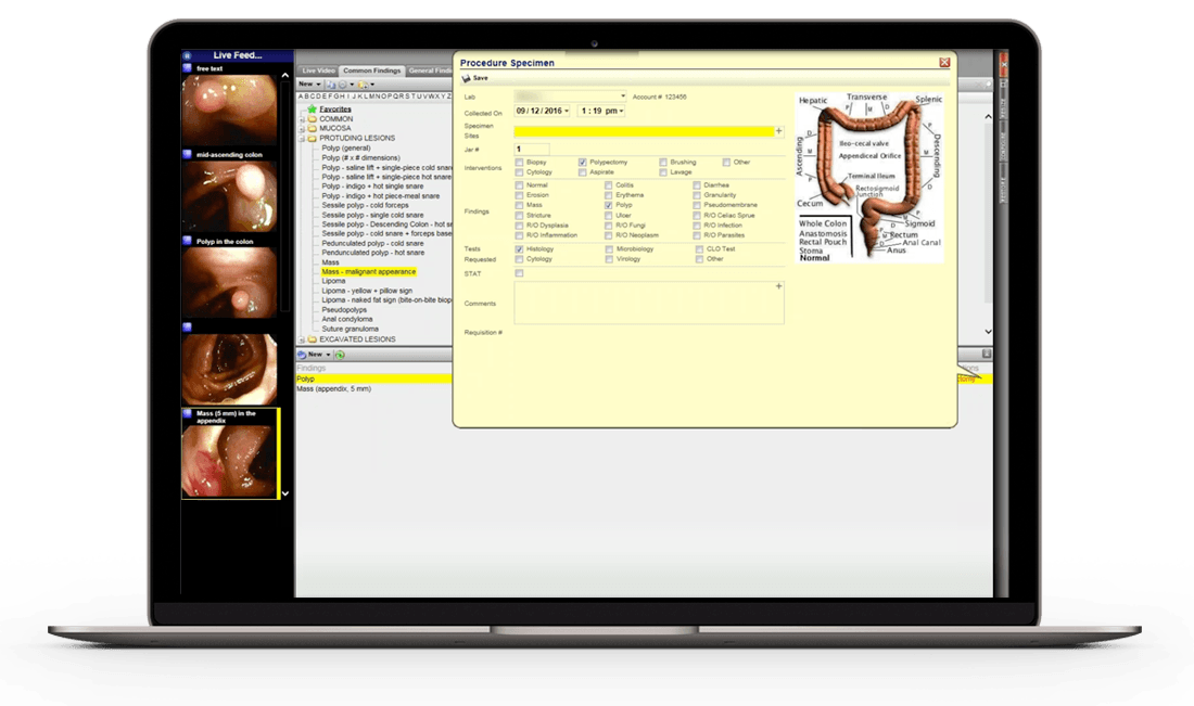 modernizing medicine gGastro Gastroenterology EHR & Endoscopy Report Writer Software