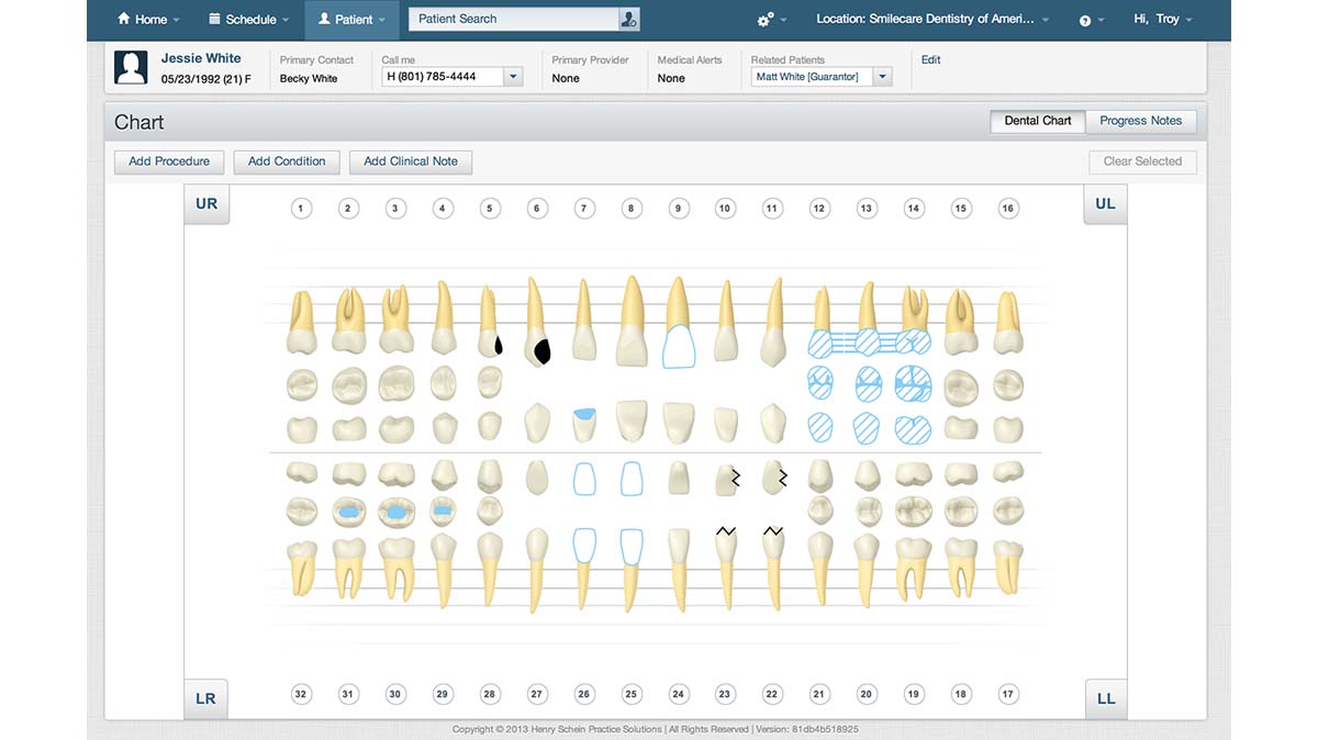 Dentrix Ascend Software EHR and Practice Management Software