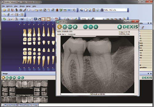 Dentrix Patient Chart