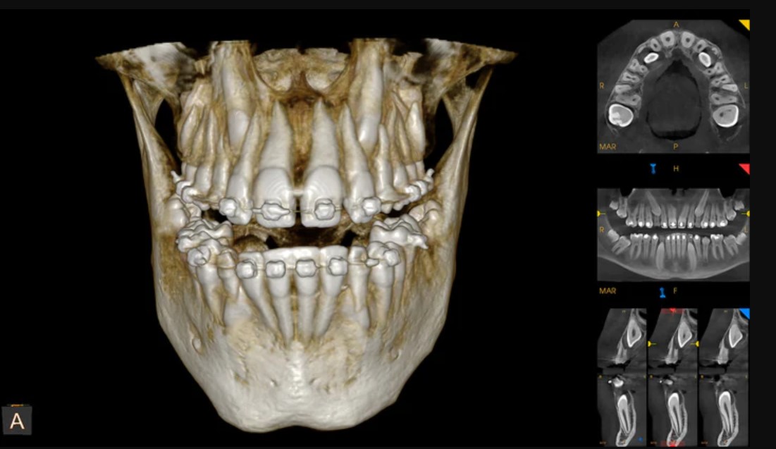 Carestream Dental EMR Software EHR and Practice Management Software