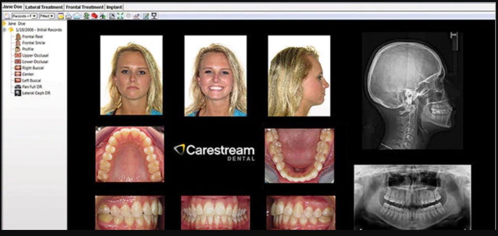 Carestream Dental EMR Software EHR and Practice Management Software