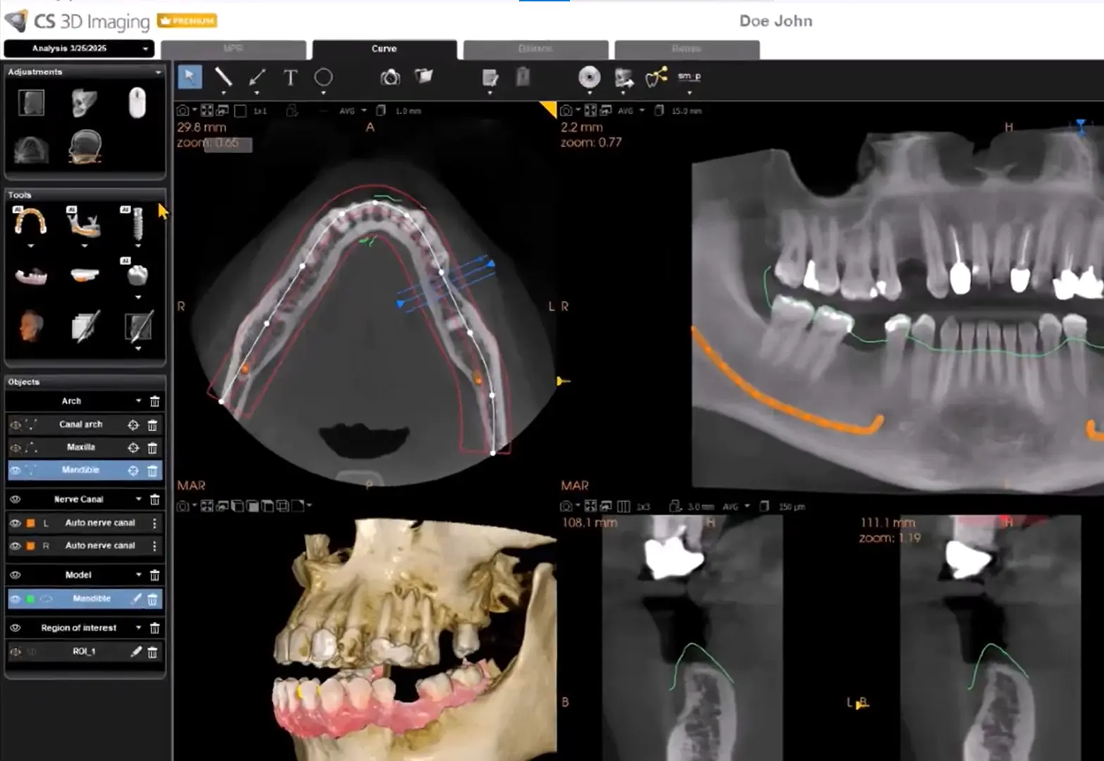Carestream Dental EMR Software EHR and Practice Management Software