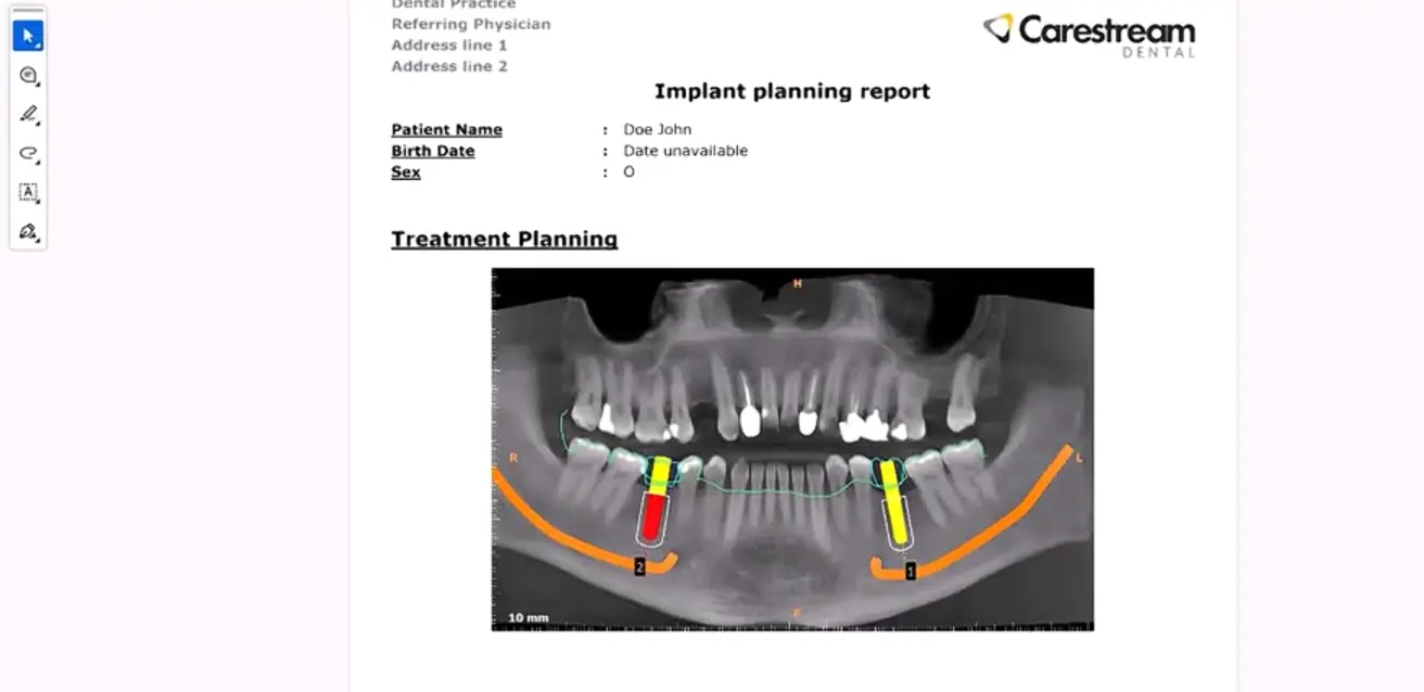 Carestream Dental EMR Software EHR and Practice Management Software